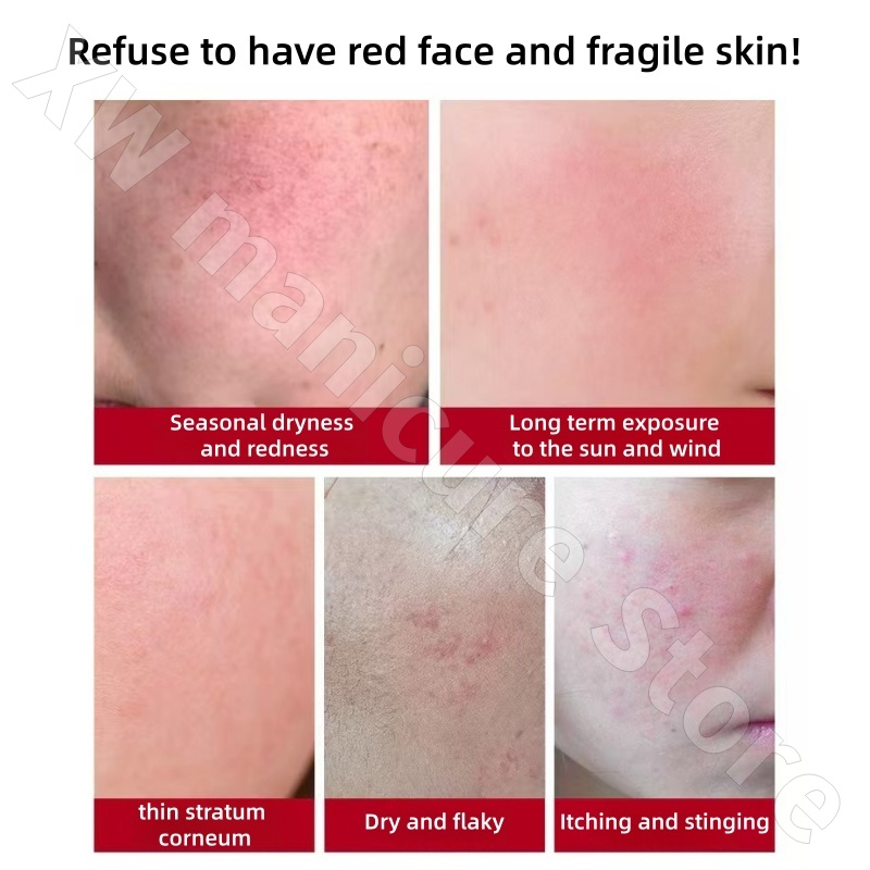 Ecdoin Repair Cream Improves S - đánh giá và giá Ceramide Moisturizer