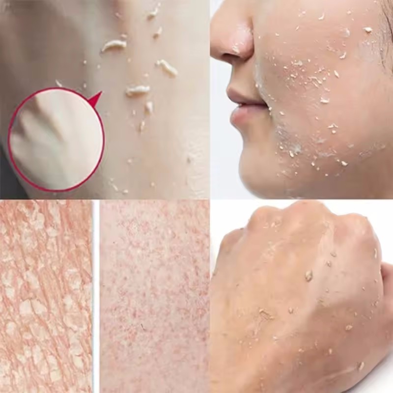 Orange Exfoliating Peeling Gel - đánh giá và giá Ceramide Moisturizer